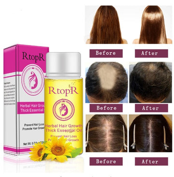 RtopR Herbal Hair Growth Thick Essential Oil