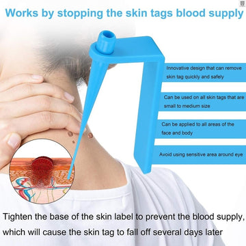 kind of skin tag remover