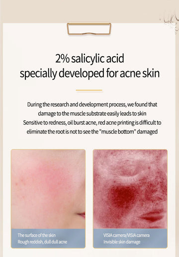 Anciyi Salicytic Acid Acne Serum