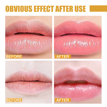 Eelhoe lip mask