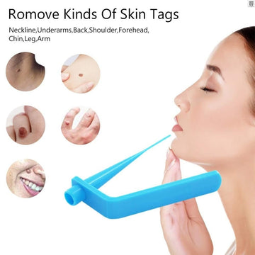 kind of skin tag remover