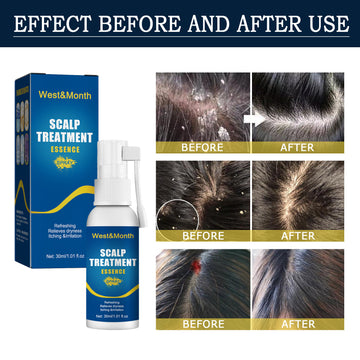 West&Month Scalp Treatment Essence Spray