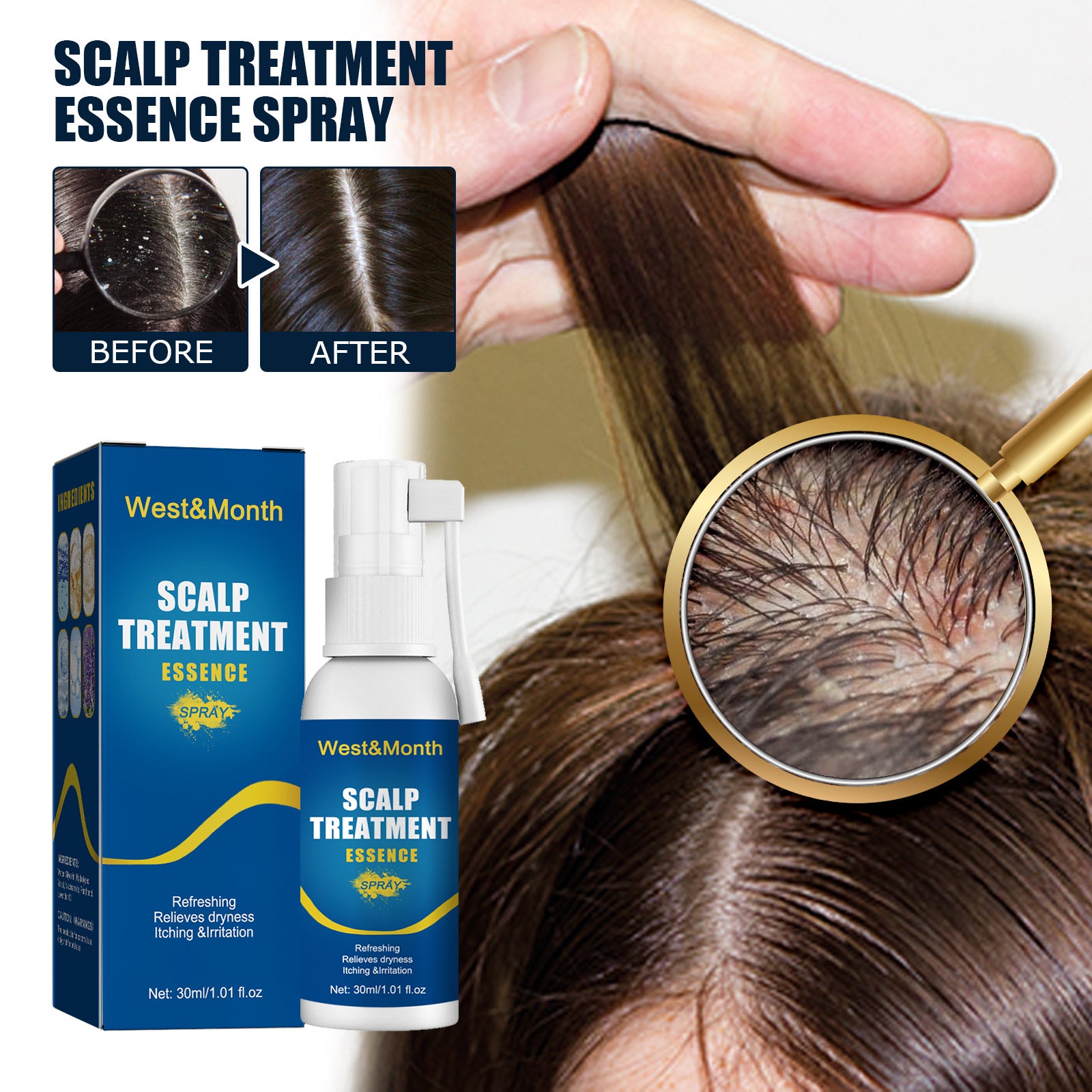 West&Month Scalp Treatment Essence Spray