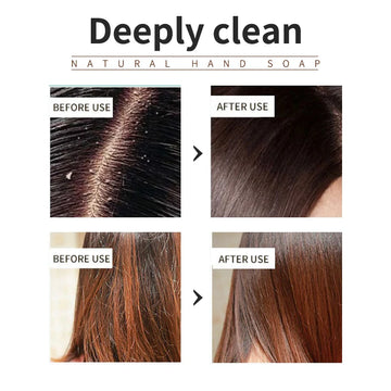 Lavender shampoo is refreshing, oil controlling, and smooth for hair, solving the problem of oily scalp without silicone oil res| GlowPeak