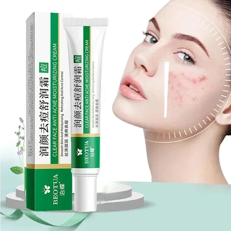 Herbal Acne Treatment Cream Face Scar Blackhead Remover Repair Gel Oil Control Shrink Pores Whitening Skin Care Korean Cosmetics| GlowPeak