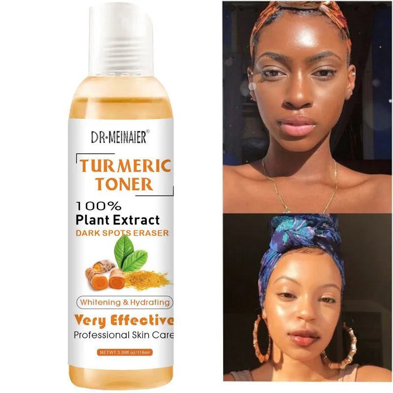 118ml Turmeric Dark Spots Toner – Dark Spot Remover & Acne Corrector, Turmeric Blemish Fade for Dark Skin – GlowPeak