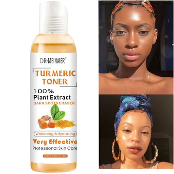 118ml Turmeric Dark Spots Toner – Dark Spot Remover & Acne Corrector, Turmeric Blemish Fade for Dark Skin – GlowPeak