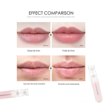 Lips booster Active Micro Roller