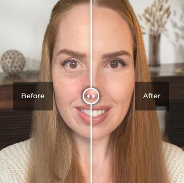Celyn Clinical Skin Care